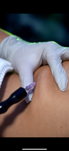 Load image into Gallery viewer, Carboxytherapy