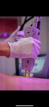Load image into Gallery viewer, Laser Hair Removal