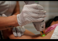 Load image into Gallery viewer, Laser Hair Removal