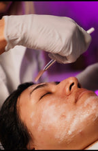 Load image into Gallery viewer, L’Vega Acne Facial